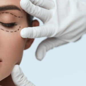 blefaroplastia em florianópolis